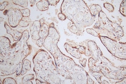 Invitrogen NAIP Recombinant Rabbit Monoclonal Antibody (13E6) 100 &mu;L;