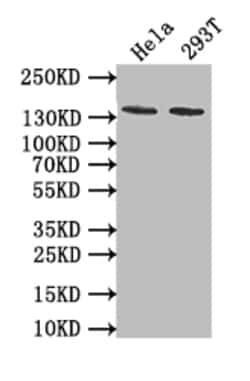 Invitrogen PKN2 Recombinant Rabbit Monoclonal Antibody (11H3) 100 &mu;L;