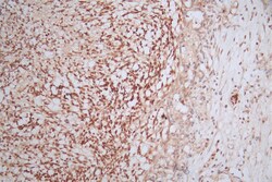 Invitrogen PAX6 Recombinant Rabbit Monoclonal Antibody (22C3) 100 &mu;L;