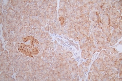 Invitrogen PAX6 Recombinant Rabbit Monoclonal Antibody (22C3) 100 &mu;L;