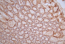 Invitrogen ERK1/ERK2 Recombinant Rabbit Monoclonal Antibody (29B10) 100