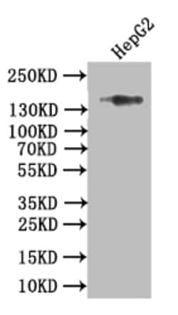 Invitrogen COL17A1 Recombinant Rabbit Monoclonal Antibody (15G9) 100 &mu;L;