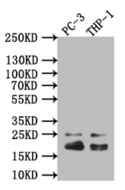 Invitrogen Caveolin 1 Recombinant Rabbit Monoclonal Antibody (2A7) 100