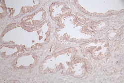 Invitrogen Claudin 5 Recombinant Rabbit Monoclonal Antibody (13G6) 100