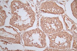 Invitrogen RAN Recombinant Rabbit Monoclonal Antibody (15A8) 100 &mu;L;
