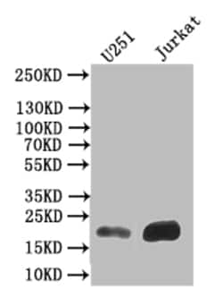 Invitrogen Ferritin Heavy Chain Recombinant Mouse Monoclonal Antibody (18C10) 100 &mu;L | Buy Online | Invitrogen&trade; | Fisher Scientific
