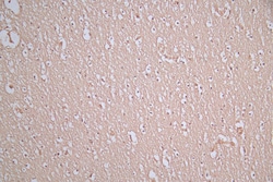 Invitrogen alpha Synuclein Recombinant Mouse Monoclonal Antibody (10E5)