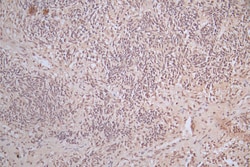 Invitrogen alpha Synuclein Recombinant Mouse Monoclonal Antibody (10E5)