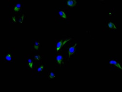 Invitrogen CEA Recombinant Rabbit Monoclonal Antibody (4D8) 100 &mu;L;