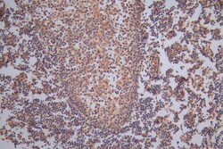 Invitrogen TK1 Recombinant Rabbit Monoclonal Antibody (15A5) 100 &mu;L;