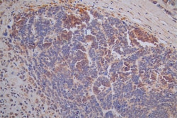 Invitrogen TK1 Recombinant Rabbit Monoclonal Antibody (15A5) 100 &mu;L;