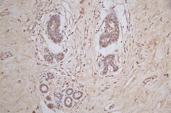 Invitrogen SNRPD1 Recombinant Mouse Monoclonal Antibody (24E2) 100 &mu;L;