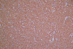 Invitrogen ROBO1 Recombinant Mouse Monoclonal Antibody (22D5) 100 &mu;L;