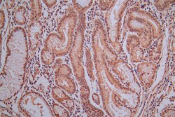 Invitrogen ROBO1 Recombinant Mouse Monoclonal Antibody (22D5) 100 &mu;L;