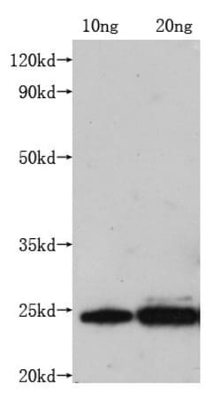 Invitrogen Rabies Virus Matrix Protein Monoclonal Antibody (1F9H6) 100