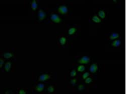 Invitrogen USP6 Monoclonal Antibody (3C3G2) 100 &mu;L; Unconjugated:Antibodies,