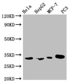 Invitrogen CCP2 Monoclonal Antibody (1F3C12) 100 &mu;L; Unconjugated:Antibodies,