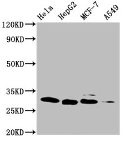 Invitrogen GSTM3 Monoclonal Antibody (1G1F1) 100 &mu;L; Unconjugated:Anticuerpos