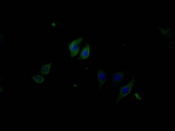 Invitrogen Phospho-PERK (Thr981) Monoclonal Antibody (4A3A10) 100 &mu;L;