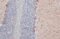 Invitrogen GAD67 Recombinant Rabbit Monoclonal Antibody (HL1096) 100 &mu;L;