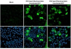 Invitrogen RSV NP Recombinant Rabbit Monoclonal Antibody (HL1248) 100 &mu;L;