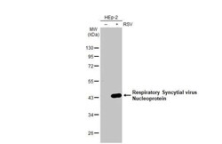 Invitrogen RSV NP Recombinant Rabbit Monoclonal Antibody (HL1248) 100 &mu;L;