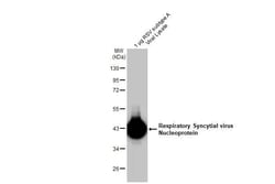 Invitrogen RSV NP Recombinant Rabbit Monoclonal Antibody (HL1296) 100 &mu;L;