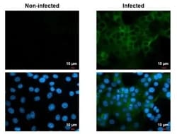 Invitrogen Chikungunya Virus NSP2 Recombinant Rabbit Monoclonal Antibody
