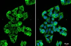 Invitrogen MC1R Recombinant Rabbit Monoclonal Antibody (HL1471) 100 &mu;L;