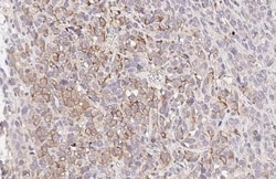 Invitrogen MC1R Recombinant Rabbit Monoclonal Antibody (HL1471) 100 &mu;L;