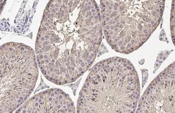Invitrogen MC1R Recombinant Rabbit Monoclonal Antibody (HL1471) 100 &mu;L;