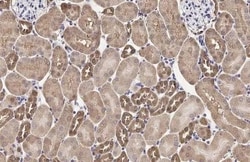 Invitrogen MC1R Recombinant Rabbit Monoclonal Antibody (HL1471) 100 &mu;L;