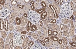 Invitrogen MC1R Recombinant Rabbit Monoclonal Antibody (HL1471) 100 &mu;L;