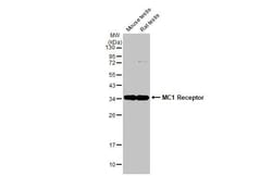 Invitrogen MC1R Recombinant Rabbit Monoclonal Antibody (HL1471) 100 &mu;L;