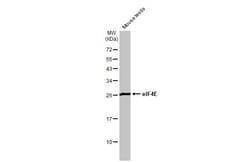 Invitrogen eIF4E Recombinant Rabbit Monoclonal Antibody (HL1554) 100 &mu;L;