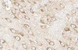 Invitrogen HSP70 Recombinant Rabbit Monoclonal Antibody (HL1580) 100 &mu;L | Buy Online | Invitrogen&trade; | Fisher Scientific