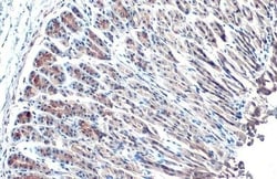 Invitrogen HSP70 Recombinant Rabbit Monoclonal Antibody (HL1580) 100 &mu;L | Buy Online | Invitrogen&trade; | Fisher Scientific
