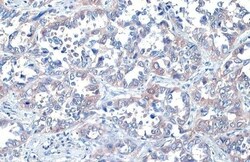 Invitrogen ROCK1/ROCK2 Recombinant Rabbit Monoclonal Antibody (HL1632)