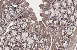 Invitrogen ROCK1/ROCK2 Recombinant Rabbit Monoclonal Antibody (HL1632)