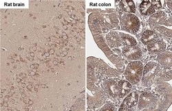 Invitrogen ROCK1/ROCK2 Recombinant Rabbit Monoclonal Antibody (HL1632)