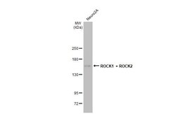 Invitrogen ROCK1/ROCK2 Recombinant Rabbit Monoclonal Antibody (HL1632)