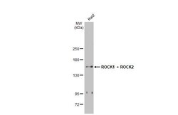 Invitrogen ROCK1/ROCK2 Recombinant Rabbit Monoclonal Antibody (HL1632)