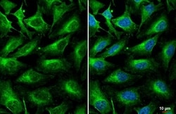Invitrogen Complement C3 Recombinant Rabbit Monoclonal Antibody (HL1643)