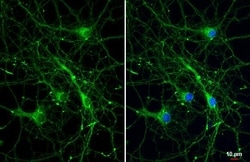 Invitrogen&trade;&nbsp;Bassoon Recombinant Rabbit Monoclonal Antibody (HL1732)