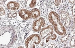 Invitrogen VEGF Recombinant Rabbit Monoclonal Antibody (HL1755) 100 &mu;L;