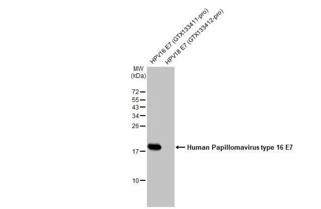 Horned Rabbit Hpv Invitrogen HPV Type 16 E7 Recombinant Rabbit Monoclonal Antibody ...