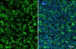 Invitrogen IBA1 Recombinant Rabbit Monoclonal Antibody (HL1880) 100 &mu;L;