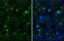 Invitrogen IBA1 Recombinant Rabbit Monoclonal Antibody (HL1880) 100 &mu;L;