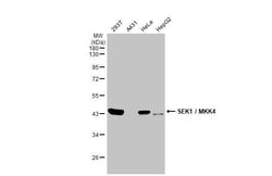 Invitrogen MAP2K4 Recombinant Rabbit Monoclonal Antibody (HL1888) 100 &mu;L;