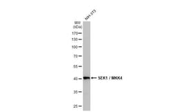 Invitrogen MAP2K4 Recombinant Rabbit Monoclonal Antibody (HL1888) 100 &mu;L;